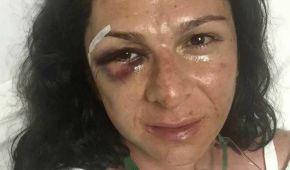 La exvelocista fue derribada de su moto y posteriormente golpeada cuando viajaba de Valle de Bravo hacia la capital