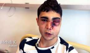Este joven de 21 años fue golpeado por los policías durante una protesta