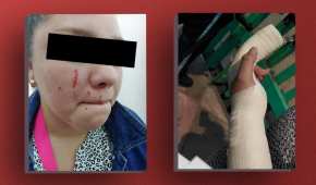 Una enfermera de la CDMX sufrió un brutal ataque por parte de una pareja que no quería que estuviera en la zona