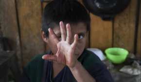 La ONG alertó de la posible agudización de la pobreza entre niños y niñas debido a la pandemia