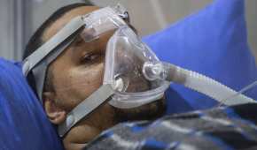 El personal de salud en Brasil se ha visto obligado a intubar pacientes sin sedantes