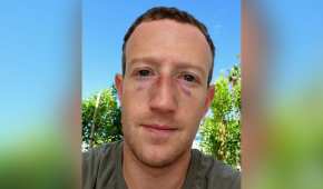 El creador de Facebook subió una foto en la se ve un poco golpeado