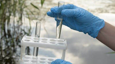 La OMS señaló que los recursos para enfrentar esta situación son muy insuficientes