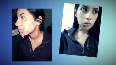 La mujer denuncio que fue brutalmente golpeada por gente que trabaja con el gobernador de Coahuila