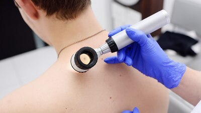 Los números de esta enfermedad son alarmantes a nivel mundial