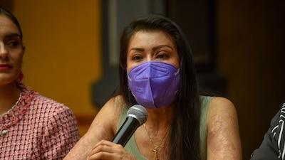 TOLUCA, ESTADO DE MÉXICO, 22ABRIL2026.- María Elena Ríos saxofonista y víctima de violencia ácida participó en el Foro Violencia Química o Ácida, Hacia su reconocimiento, prevención y sanción en el Estado de México, organizado por la diputada local Zaira Cedillo Silva. FOTO: CRISANTA ESPINOSA AGUILAR/CUARTOSCURO.COM