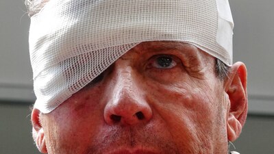 El actor reveló que procederá contra los atacantes que lo lesionaron