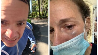 Una mujer que corría en un arque fue golpeada por un sujeto