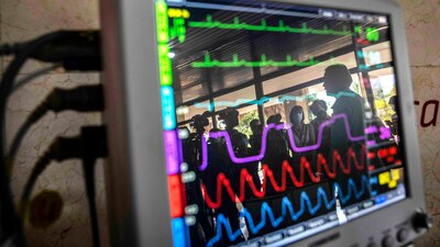 Cuba puso su industria estatal médica en función del combate a COVID-19 y desarrolla respiradores