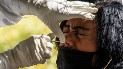 El test debe tener una antigüedad máxima de 72 horas y con resultado negativo.