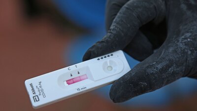 Las pruebas serológicas no son un reemplazo para las de antígeno o PCR que requieren un hisopado.