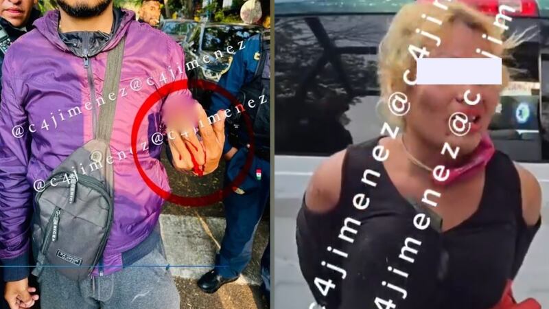 Detienen a mujer que asaltó a joven; de una mordida le arrancó el dedo