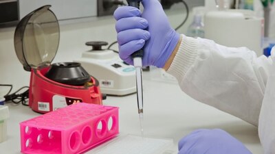 El Ministerio de Ciencia y Tecnología indicó que la molécula DR-10 fue identificada por investigadores venezolanos,