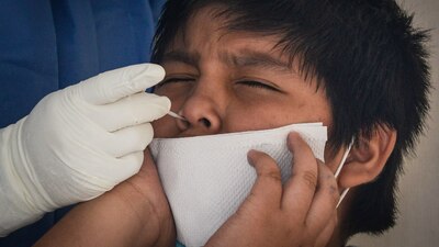 Los casos de coronavirus en menores de edad pasaron de 84 a 60 mil 928 del 12 de abril de 2020 al 8 de agosto de 2021