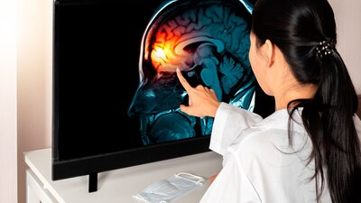 Las dependencias de salud siguen detectando personas con meningitis