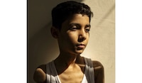 Retrato de niño palestino amputado por la guerra en Gaza es Foto del Año de World Press Photo