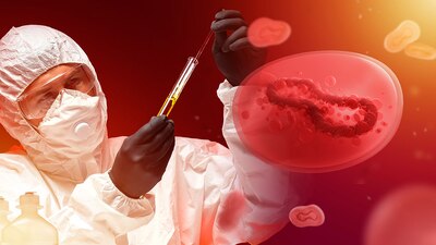 En Hidalgo reportó el primer caso de esta enfermedad