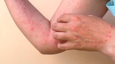 Jalisco es la segunda entidad con más contagios en el país