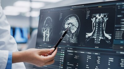 El chip insertado en el cerebro del paciente es del tamaño de una moneda