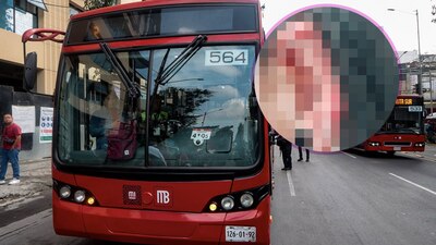 En redes sociales señaló que le tuvieron que suturar la herida