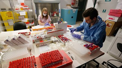 Italia también está trabajando para tener sus dosis lo antes posible