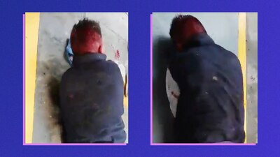 El hombre, quien presuntamente era asaltante, quedó fuertemente golpeado