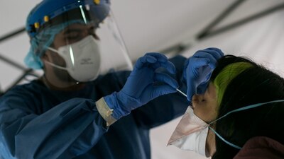 El país realiza solo alrededor de tres por cada 100 mil personas, según la OMS