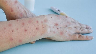 El gobierno afirma que las medidas de higiene por COVID ayudan a la no propagación del virus