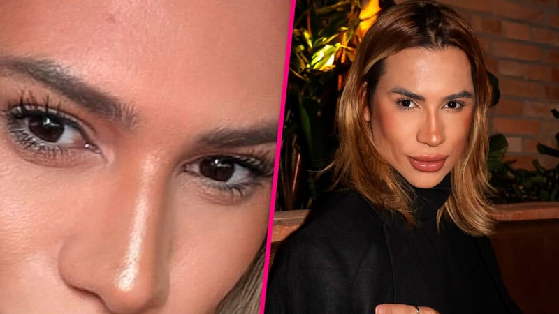 Muere el influencer Junior Dutra tras complicaciones por cirugía estética ‘foxy eyes’