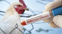Confirman primer caso humano de influenza aviar A (H5N1) en México