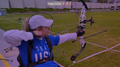 Por un ataque de su expareja, Tracy perdió el ojo, la movilidad parcialmente y la capacidad de sudar