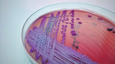 Es una enfermedad endémica de lugares con clima tropical como el sudeste de Asia y el norte de Australia