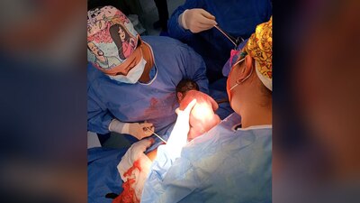 El bebé nació con un peso de 2 mil 550 gramos