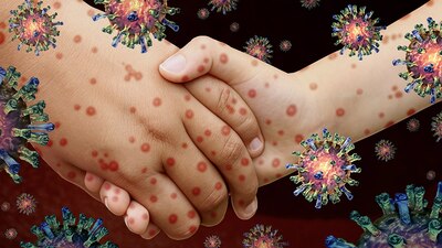 El primer caso fue detectado en marzo de este año