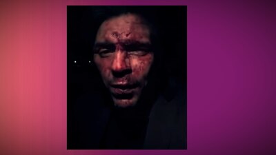 El joven afirma que fue golpeado por Arturo Montiel, exgobernador del Edomex