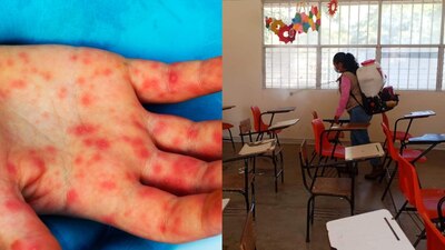 Cerraron una escuela por un brote, pero no ha sido la única con este problema