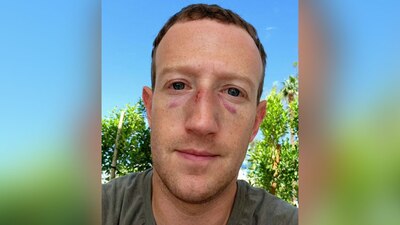 El creador de Facebook subió una foto en la se ve un poco golpeado