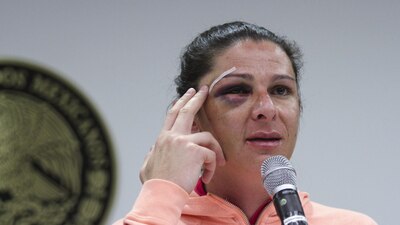 El pasado 11 de diciembre, la legisladora del PT fue golpeada cuando regresaba a la Ciudad de México en su motocicleta