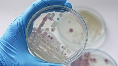Es una bacteria que se encuentra en el agua de mar cálida