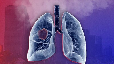 La mala calidad del aire produce afectaciones a toda la población