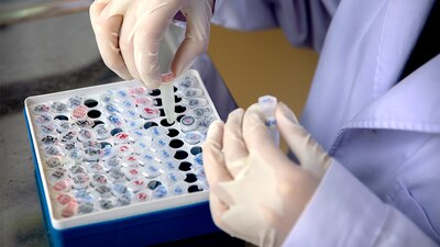 En diferentes países trabajan a marchas forzadas para encontrar la vacuna contra el COVID-19