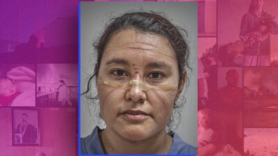 El fotógrafo participó con la foto de una doctora en cuyo rostro se aprecian cicatrices por el material contra COVID