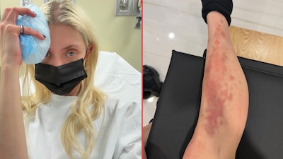 Hospitalizan a la cantante Taylor Momsen por picadura de araña previo a show en México