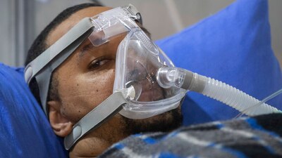 El personal de salud en Brasil se ha visto obligado a intubar pacientes sin sedantes