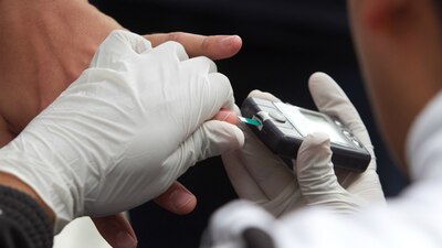 El gobierno dijo que implementará una estrategia para prevenir estas enfermedades