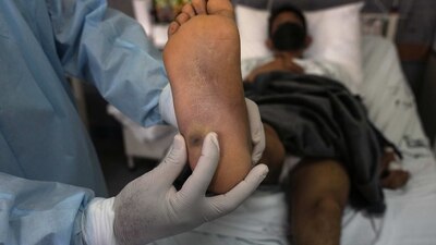 En el país, se detectaron más de 200 nuevos contagios en una semana