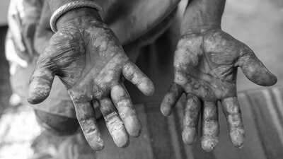 La dependencia contabiliza 300 afectados; pone especial atención a 12 municipios