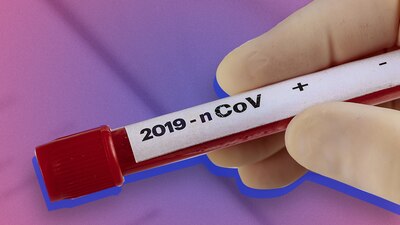 hasta el momento se han detectado 400 casos en China