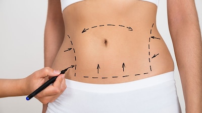 Van desde los 40 mil, hasta los 105 mil pesos, mismas que se pagarían del erario