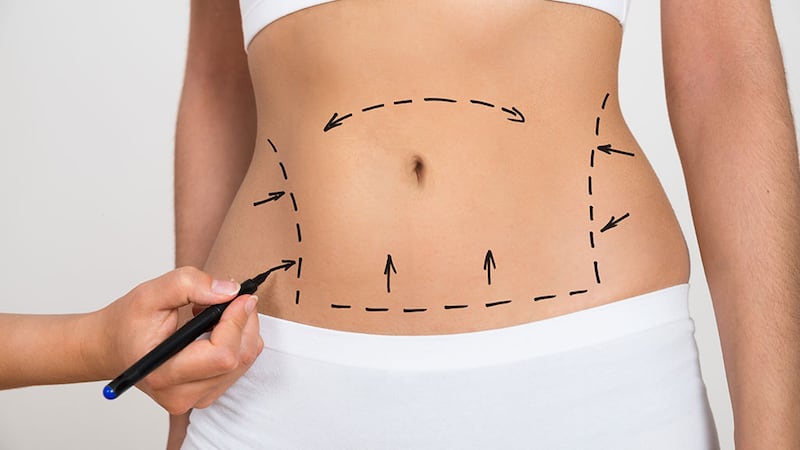 Cirugías estéticas, la nueva propuesta de los candidatos para ganar popularidad